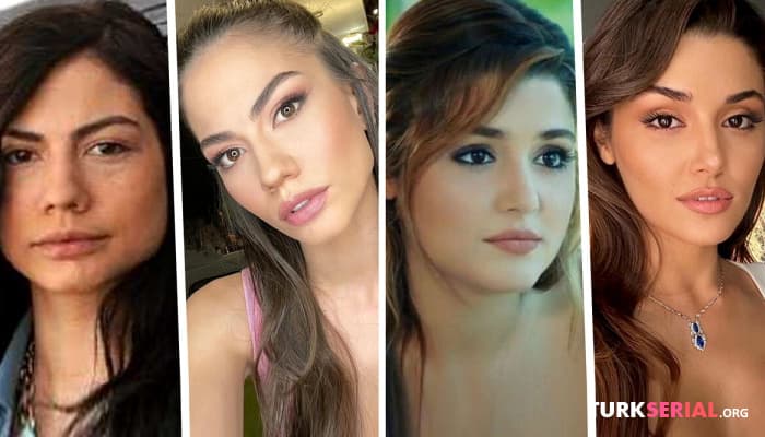 сериал Турецкие известные актрисы до и после пластических операций