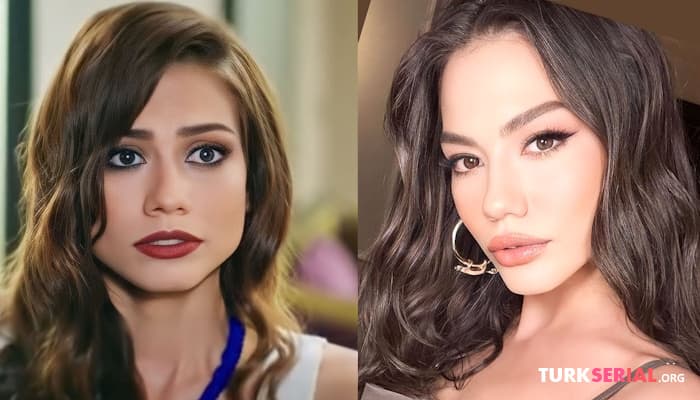 сериал Турецкие знаменитые актрисы ДО и ПОСЛЕ пластики